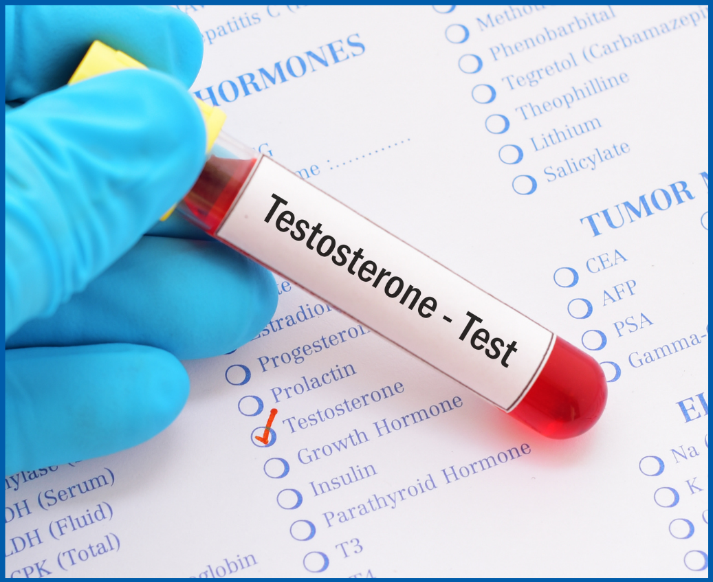 Testosterone test sample in a test tube
